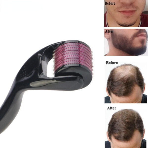 Derma Roller For Hair Regrowth - Image 5