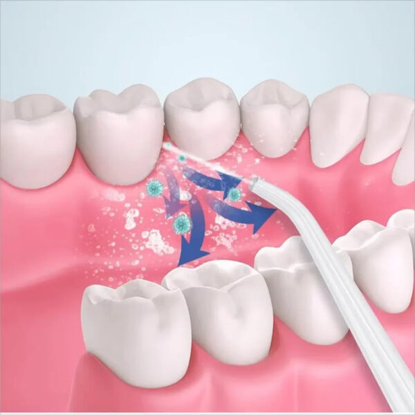 3 In 1 Oral Irrigator - Image 6
