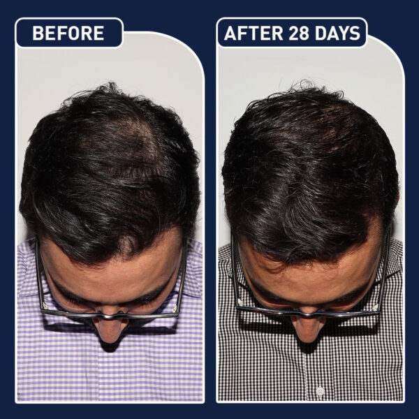FEG Plus Hair Spray - Image 2