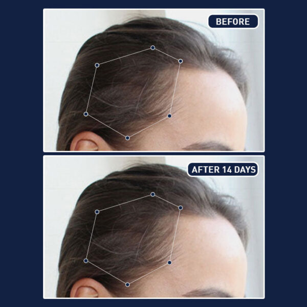 FEG Plus Hair Spray - Image 3