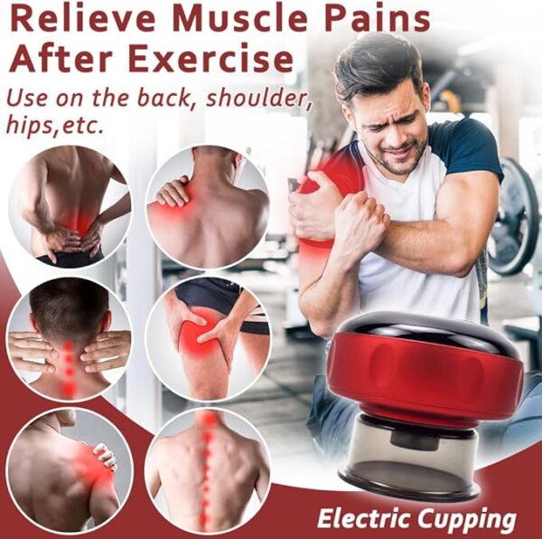 Smart Cupping Massager - Image 3