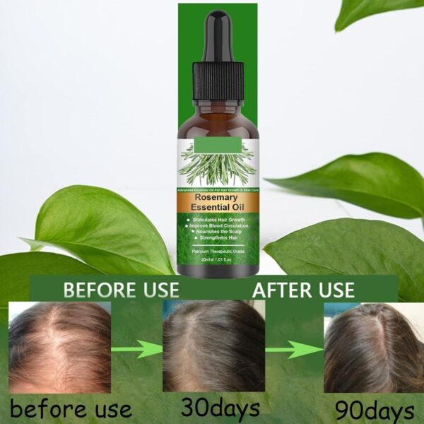 Rosemary Flourish Oil for Hair Growth 30ml - Image 2